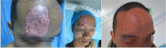 南宁病例对比.jpg