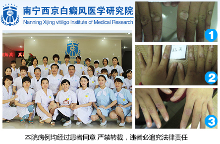 南宁西京白癜风研究院.jpg