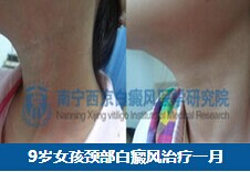 南宁治疗白癜风.jpg