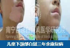南宁治疗白癜风医院.jpg