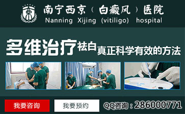 青少年白癜风怎么治疗