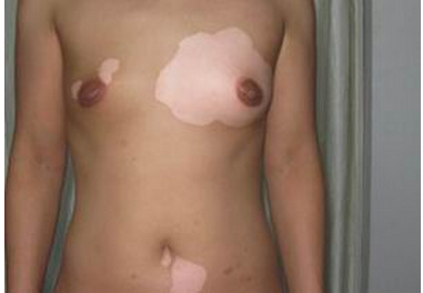 出现白点是怎么回事