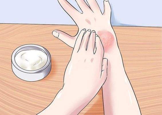 老年人白癜风的治疗方法