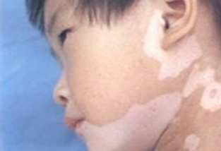 Ãæ²¿°×ñ°·ç£¬Òª»ý¼«µÄÔ¤·À