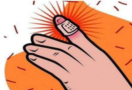 皮肤烧伤后有白斑是白癜风吗